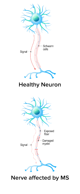 Neurology - AZ Integrated Neuro Spine & Pain